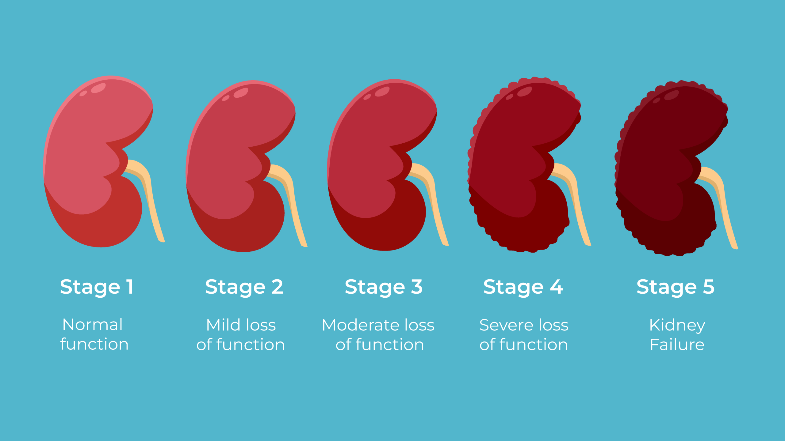 The_5_Stages_of_Chronic_Kidney_Disease_HN3600_Cover_Sized